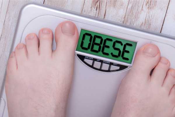 Obesitas: Pandangan Komprehensif tentang Epidemi Global